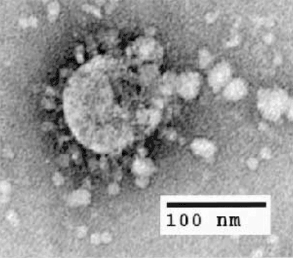 Электронно-микроскопическое изображение SARS-CoV